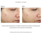 PURIFYING SPOT GEL Blemish Cleansing Tx - .34 fl oz