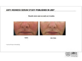 Anti-Redness Serum