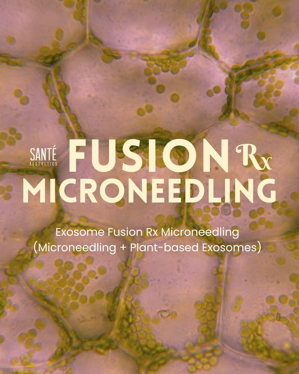 Exosome Fusion Rx (Fusion Tip Microneedling + Plant-based Exosomes)